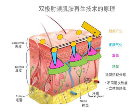 李佳齊推薦的便攜式美容儀,歐姆龍輕觸開關(guān)性價(jià)比王炸!